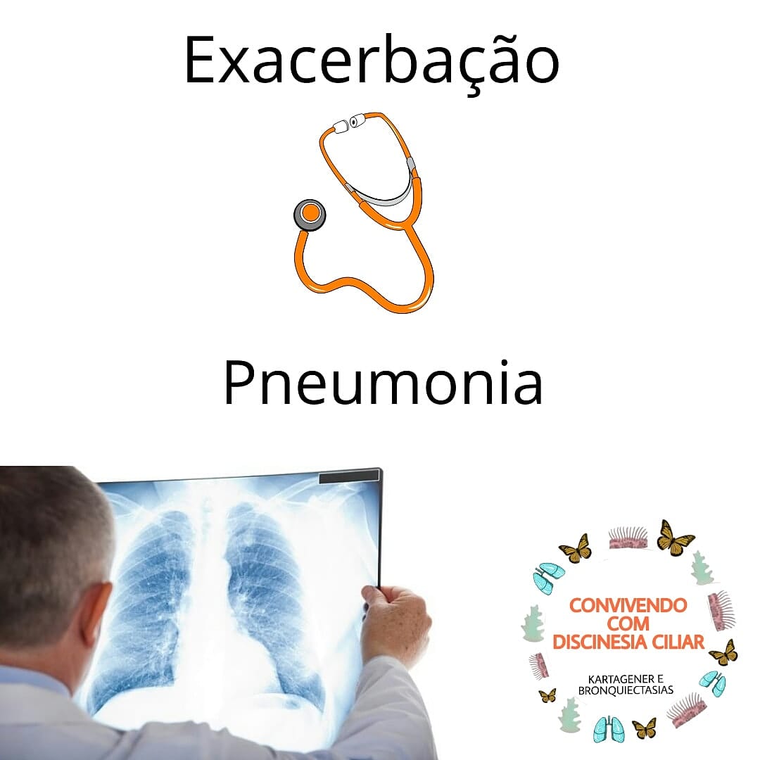 Exacerbação/Pneumonia